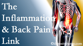 Moriarty Chiropractic tackles the inflammatory process that accompanies back pain as well as the pain itself.
