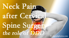 Moriarty Chiropractic offers gentle care for neck pain after neck surgery.