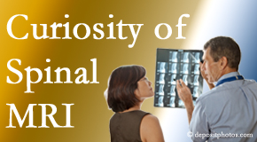 Nashua MRIs for spinal stenosis may be revealing…or puzzling.