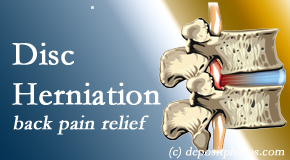 Moriarty Chiropractic uses non-surgical treatment for relief of disc herniation related back pain. 