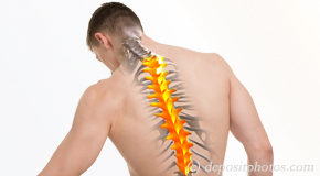 Nashua thoracic spine pain image