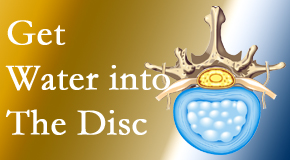 Moriarty Chiropractic uses spinal manipulation and exercise to boost the diffusion of water into the disc which supports the health of the disc.