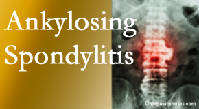Ankylosing spondylitis is gently cared for by your Nashua chiropractor.