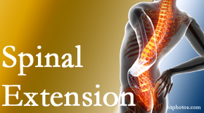 Moriarty Chiropractic knows the role of extension in spinal motion, its necessity, its benefits and potential harmful effects. 