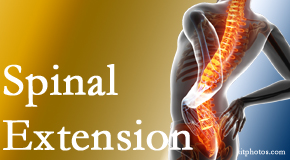 Moriarty Chiropractic knows the role of extension in spinal motion, its necessity, its benefits and potential harmful effects.