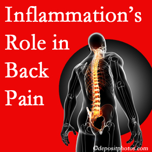 The role of inflammation in Nashua back pain is real. Chiropractic care can manage it.
