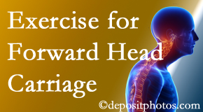 Nashua chiropractic treatment of forward head carriage is two-fold: manipulation and exercise.