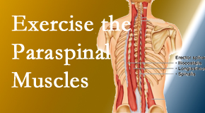 Moriarty Chiropractic explains the importance of paraspinal muscles and their strength for Nashua back pain relief.