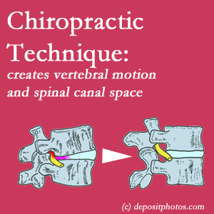 image of a Nashua spinal stenotic canal