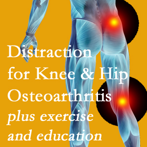 A chiropractic treatment plan for Nashua knee pain and hip pain due to osteoarthritis: education, exercise, distraction.