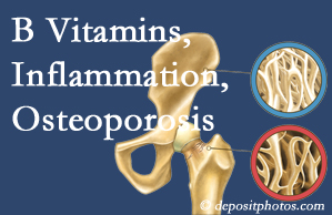Nashua chiropractic care of osteoporosis usually comes with nutritional tips like b vitamins for inflammation reduction and for prevention.