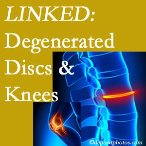 Degenerated discs and degenerated knees are not such unlikely companions. They are seen to be related. Nashua patients with a loss of disc height due to disc degeneration often also have knee pain related to degeneration. 
