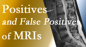 Moriarty Chiropractic carefully decides when and if MRI images are needed to guide the Nashua chiropractic treatment plan.